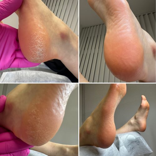 6FD7E630-FFA8-4433-BC94-39708D67D221