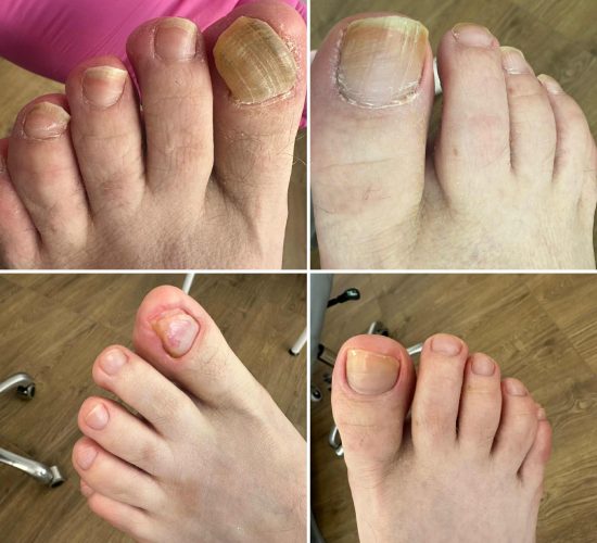 sterylny podolog galeria