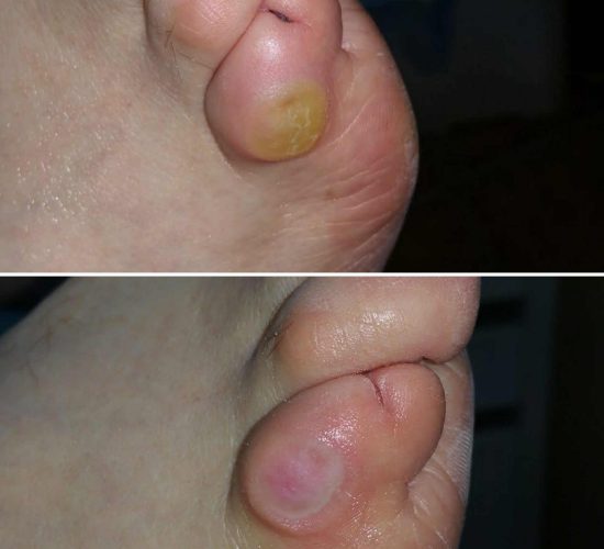 Zabiegi podologiczne warszara